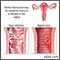 Causes of painful intercourse