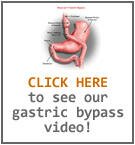 CLick here to see our gastric bypass surgery video!